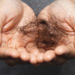 女性の薄毛の原因と対策、最新の治療法と費用について解説！:アイキャッチ